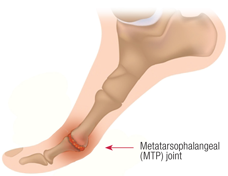JF20_Myoskeletal1 JF20_Myoskeletal1