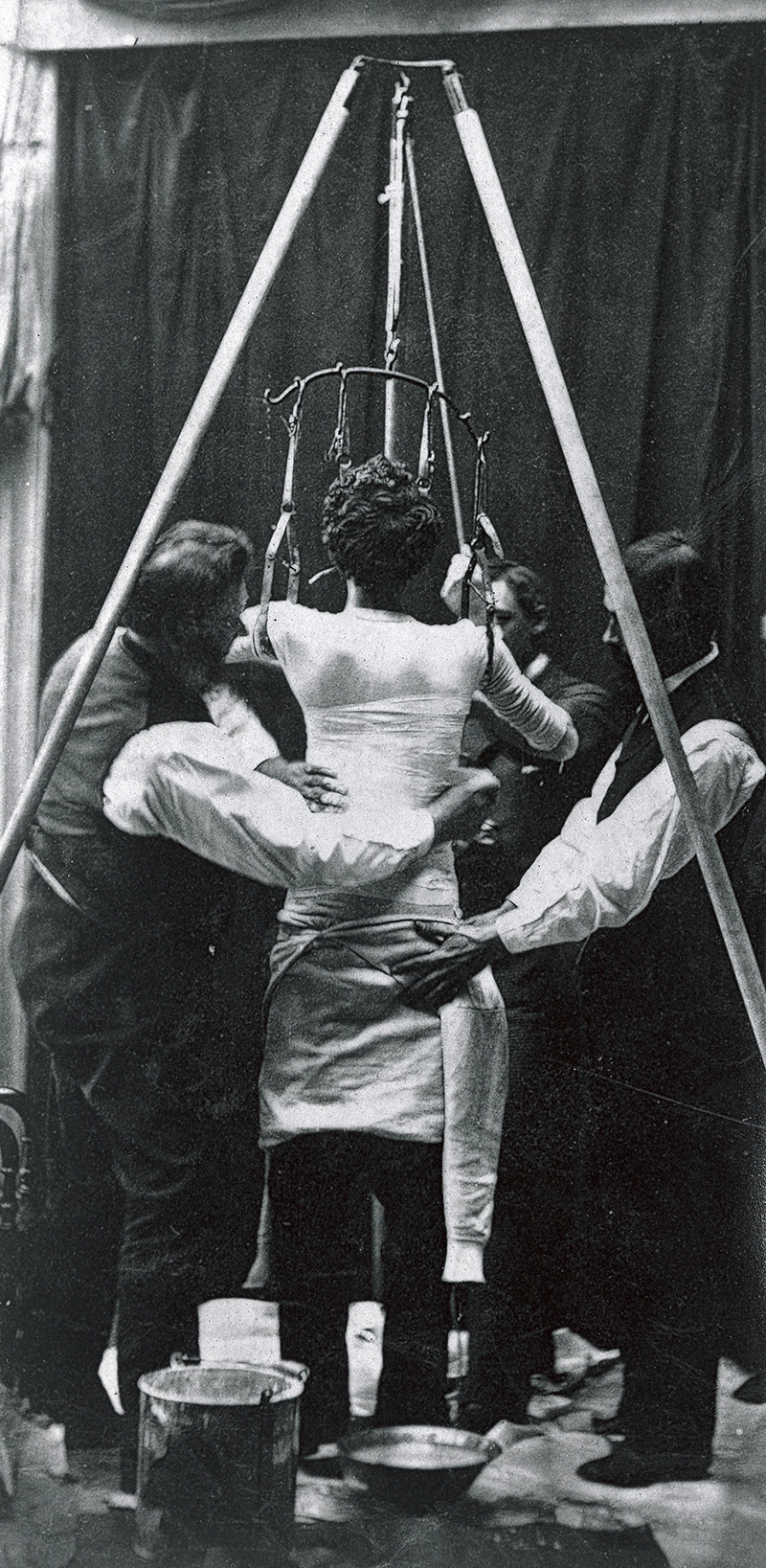 MA20 Scoliosis 4 MA20 Scoliosis 4