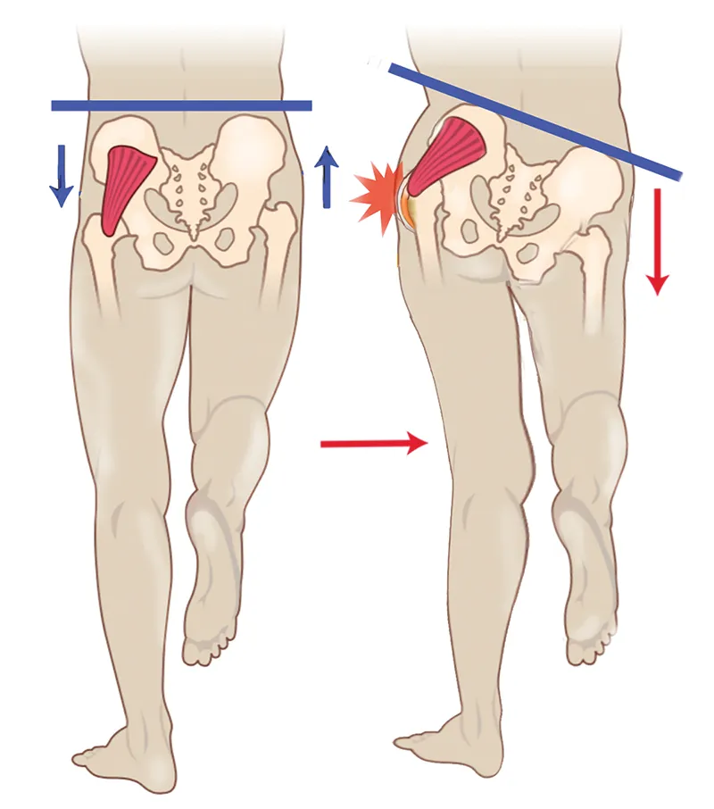 SO19_Healing the Hips4