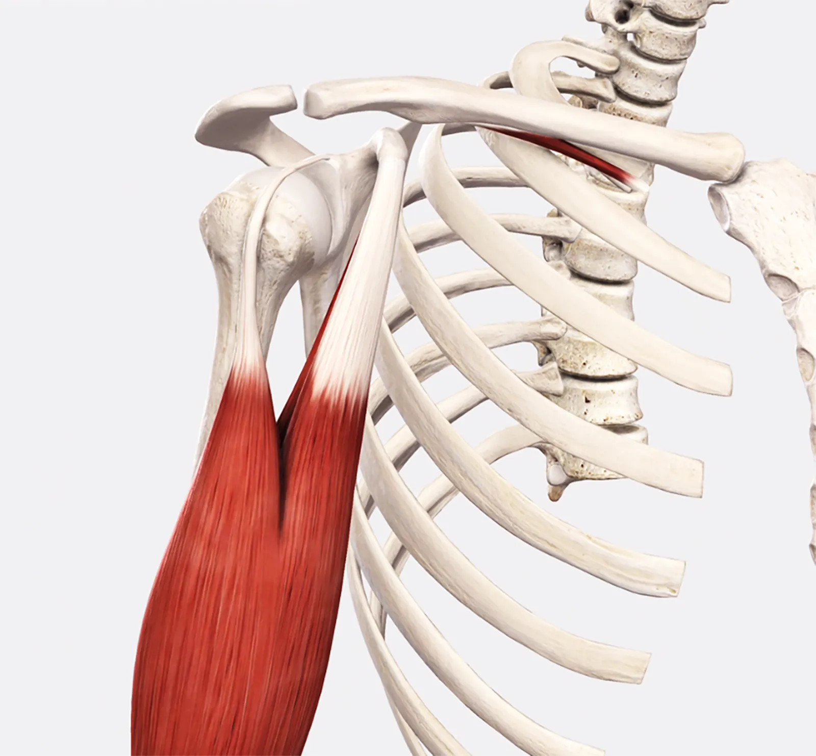 Bicipital Tendinopathy Teaser Image