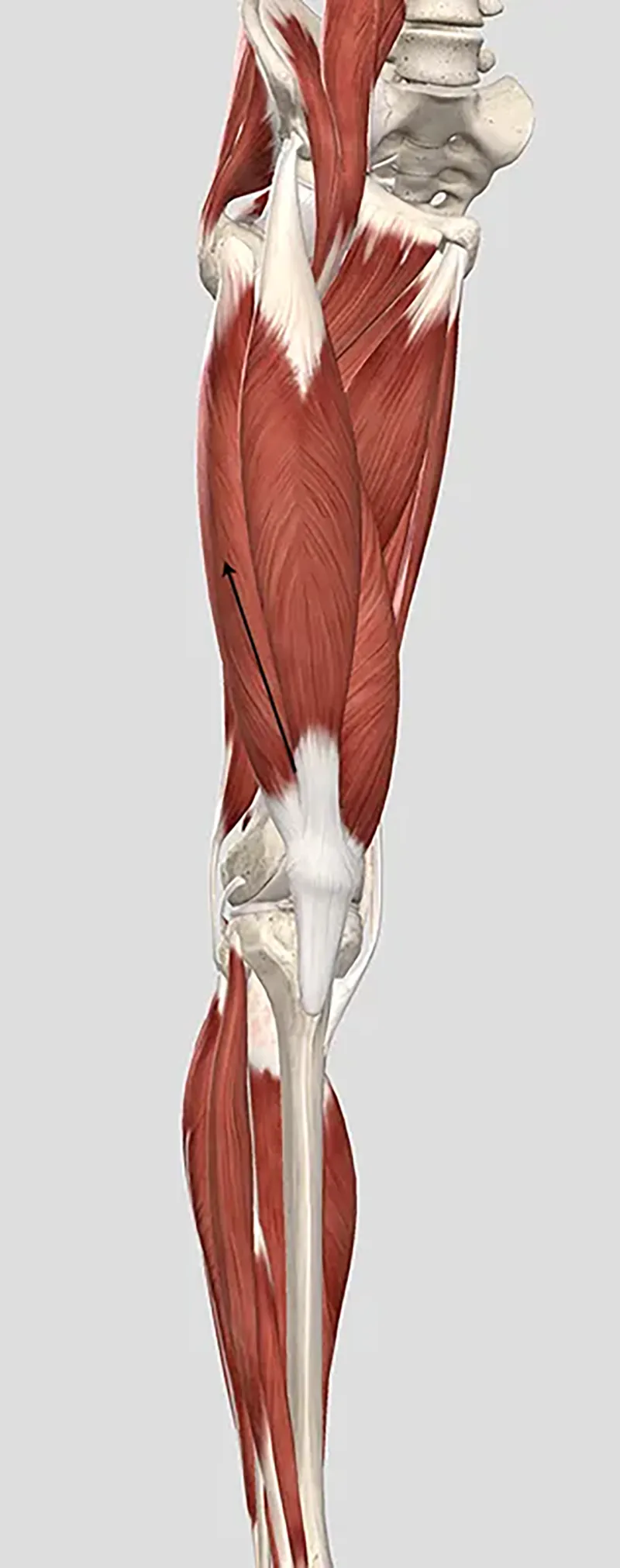 JA20_Grind Patellae3