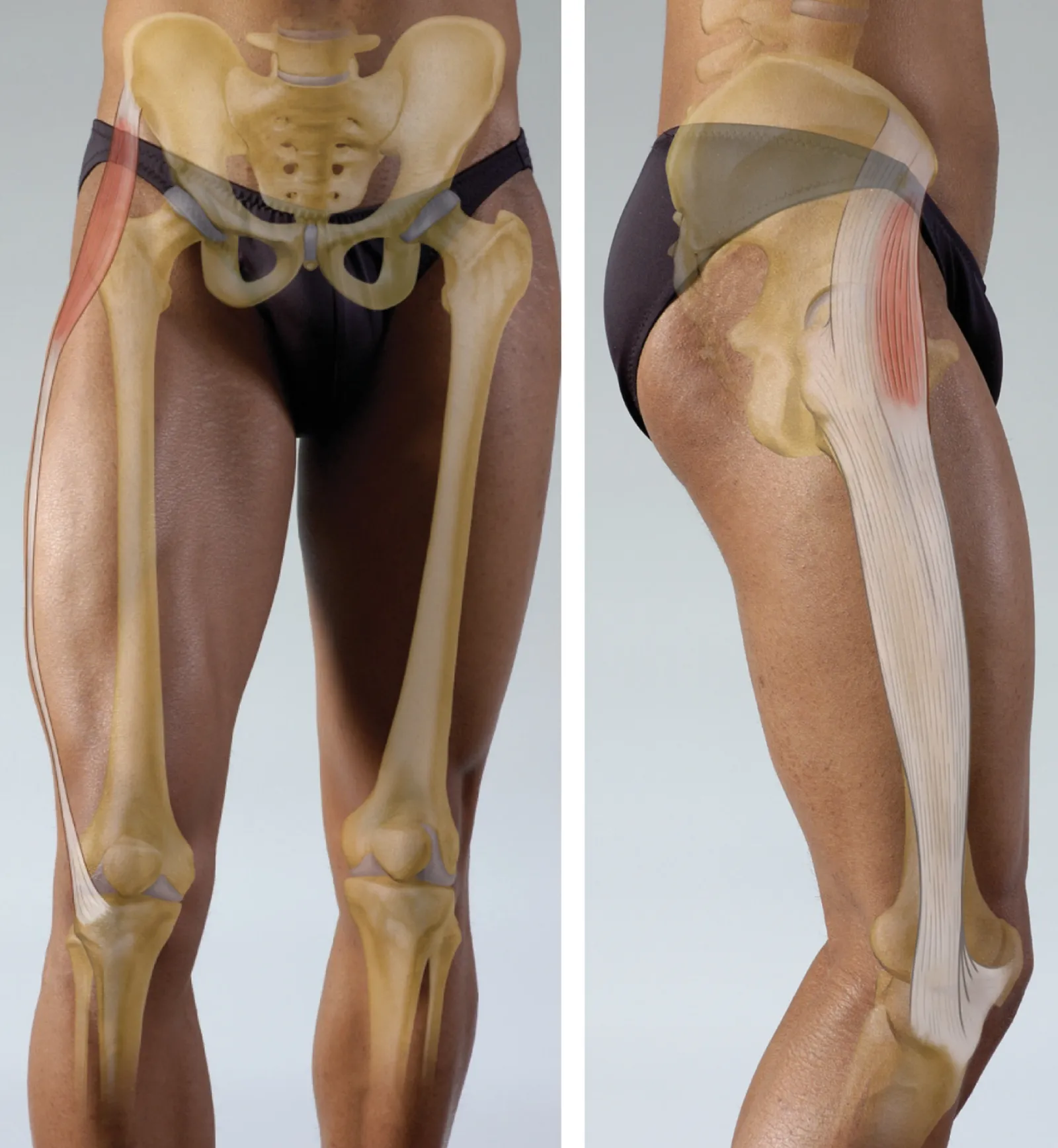 Tensor Fasciae Latae Teaser Image